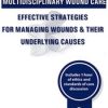 Carmen Thompson – Multidisciplinary Wound Care