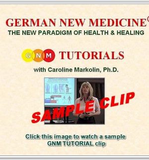 Caroline Markolin – German New Medicine Tutorials 1-5